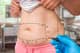 Slider image (7) Dr. Asim Uslu - Plastic Surgeon in Antalya, Turkey